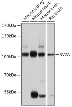 SV2A Rabbit Polyclonal Antibody