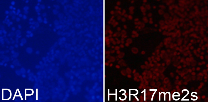 Symmetric DiMethyl-Histone H3-R17 Rabbit Polyclonal Antibody - Image 3