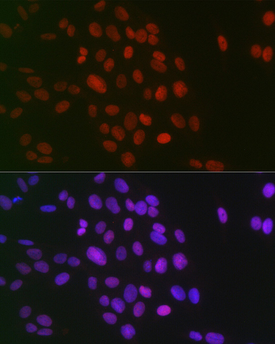Symmetric DiMethyl-Histone H3-R26 Rabbit Polyclonal Antibody - Image 3
