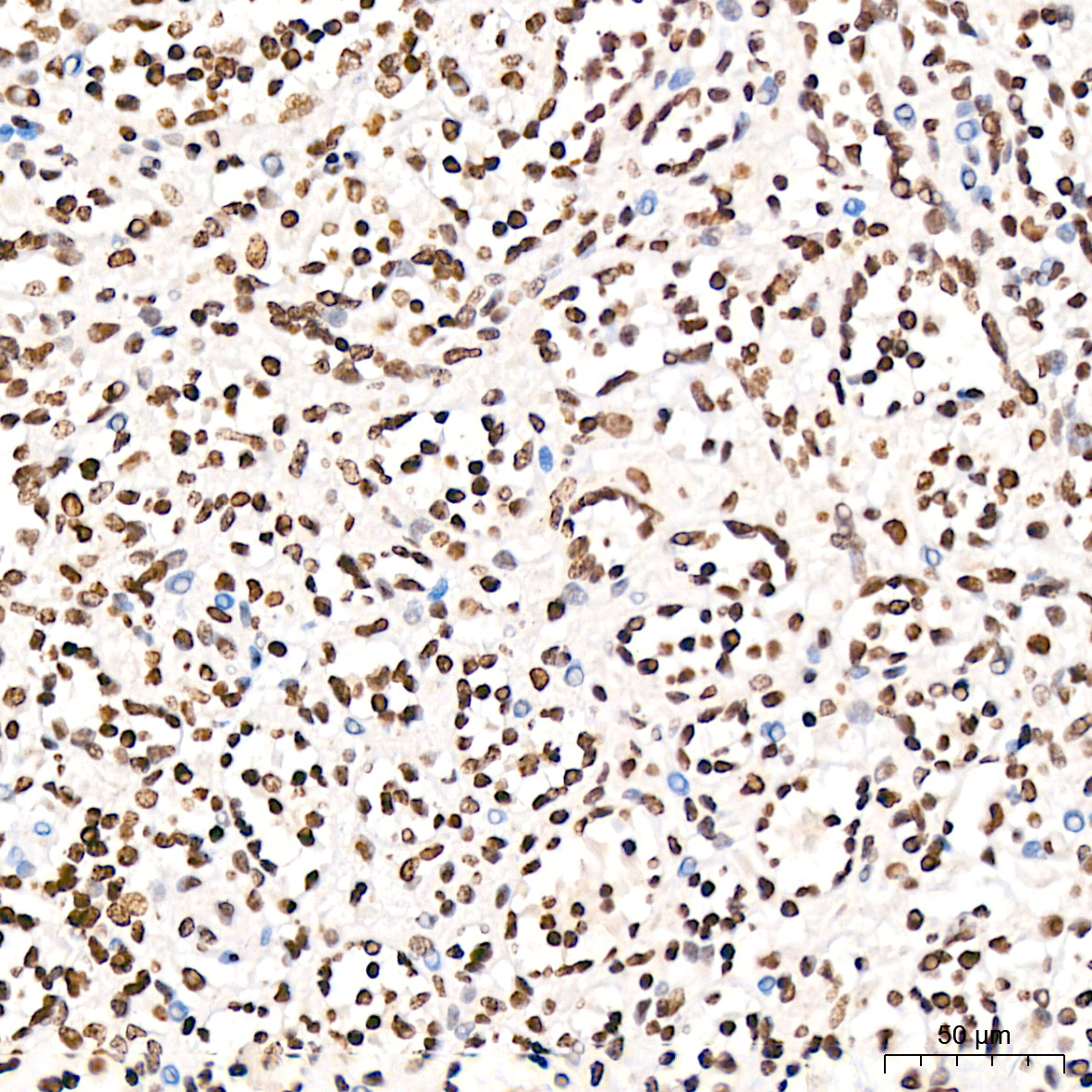 Symmetric DiMethyl-Histone H4-R3 Rabbit Polyclonal Antibody - Image 2