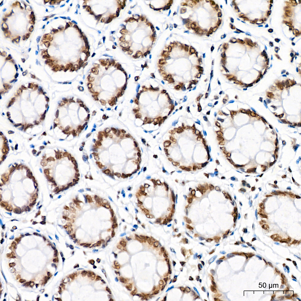 Symmetric DiMethyl-Histone H4-R3 Rabbit Polyclonal Antibody - Image 5