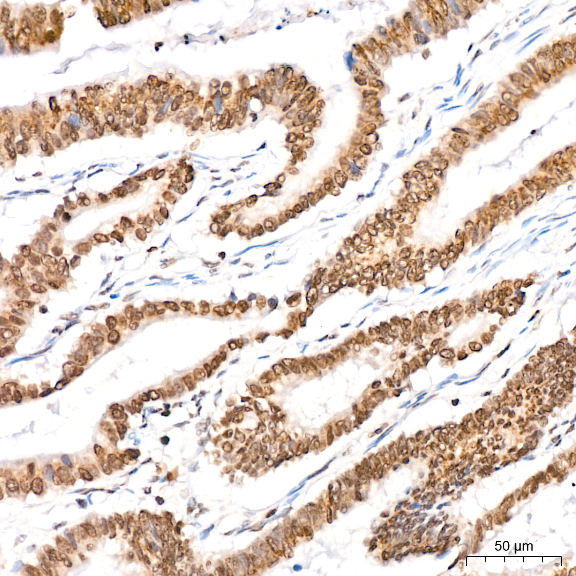 Symmetric DiMethyl-Histone H4-R3 Rabbit Polyclonal Antibody - Image 6