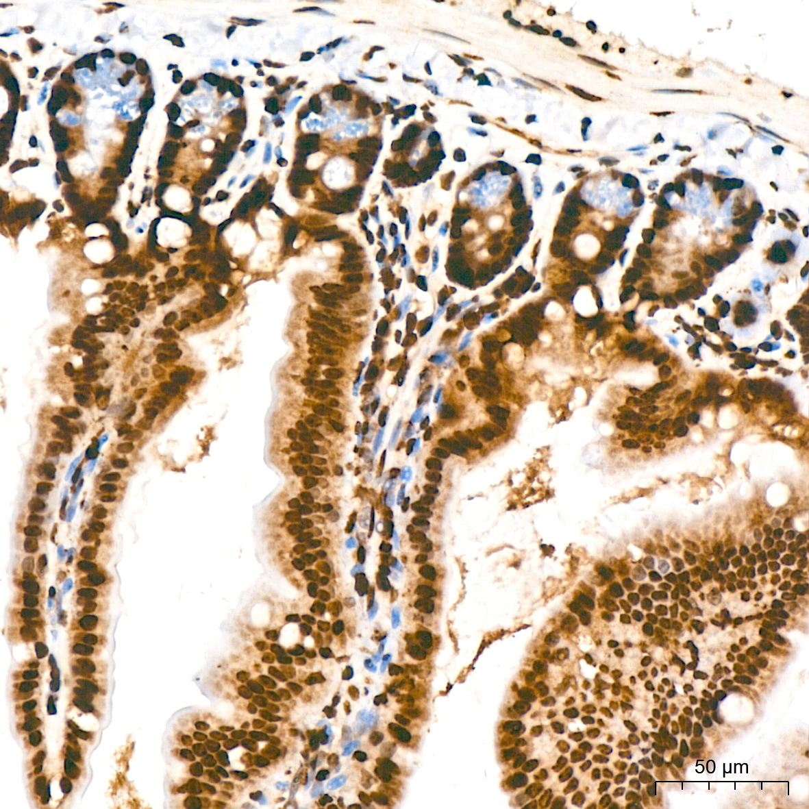 Symmetric DiMethyl-Histone H4-R3 Rabbit Polyclonal Antibody - Image 10