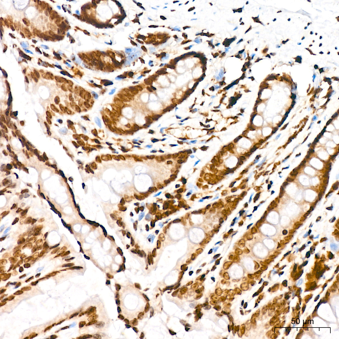 Symmetric DiMethyl-Histone H4-R3 Rabbit Polyclonal Antibody - Image 11