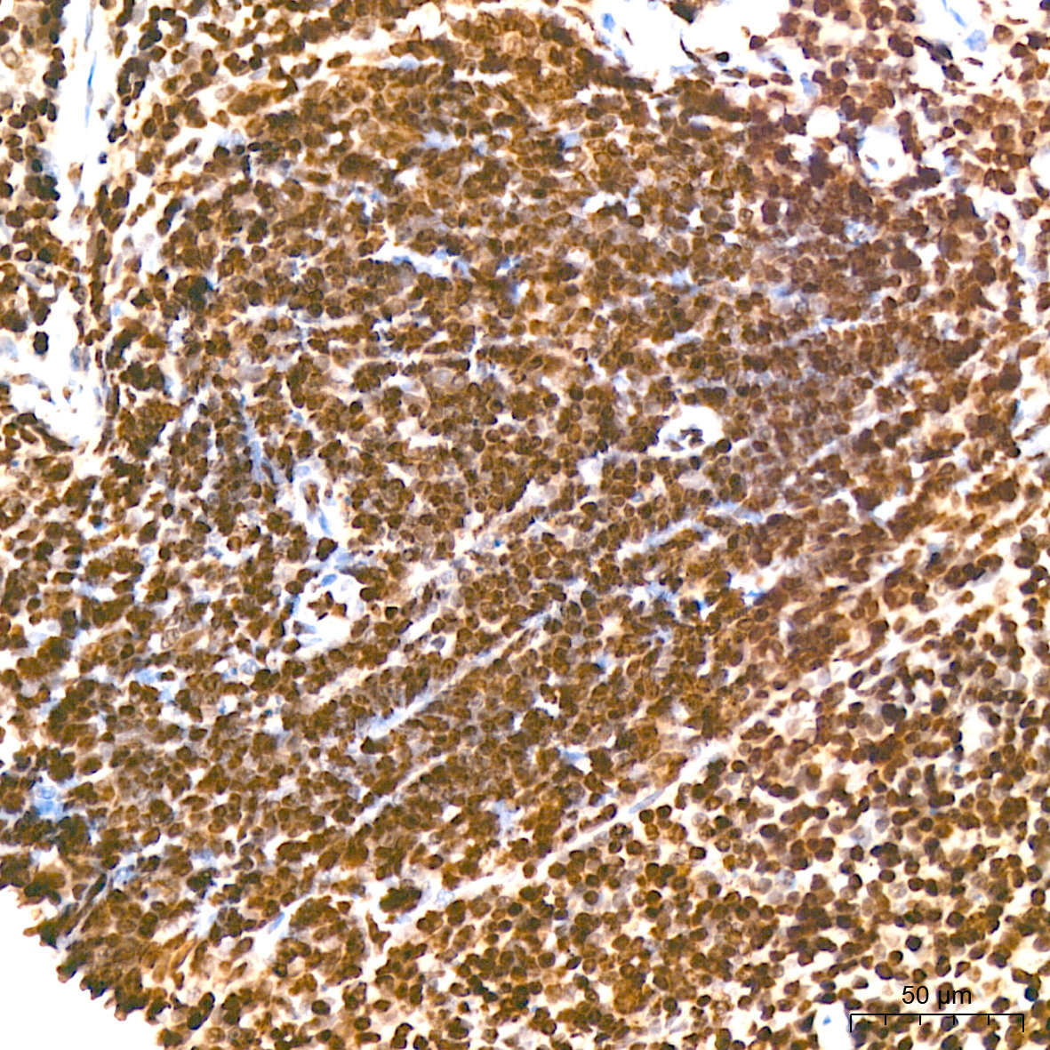 Symmetric DiMethyl-Histone H4-R3 Rabbit Polyclonal Antibody - Image 12