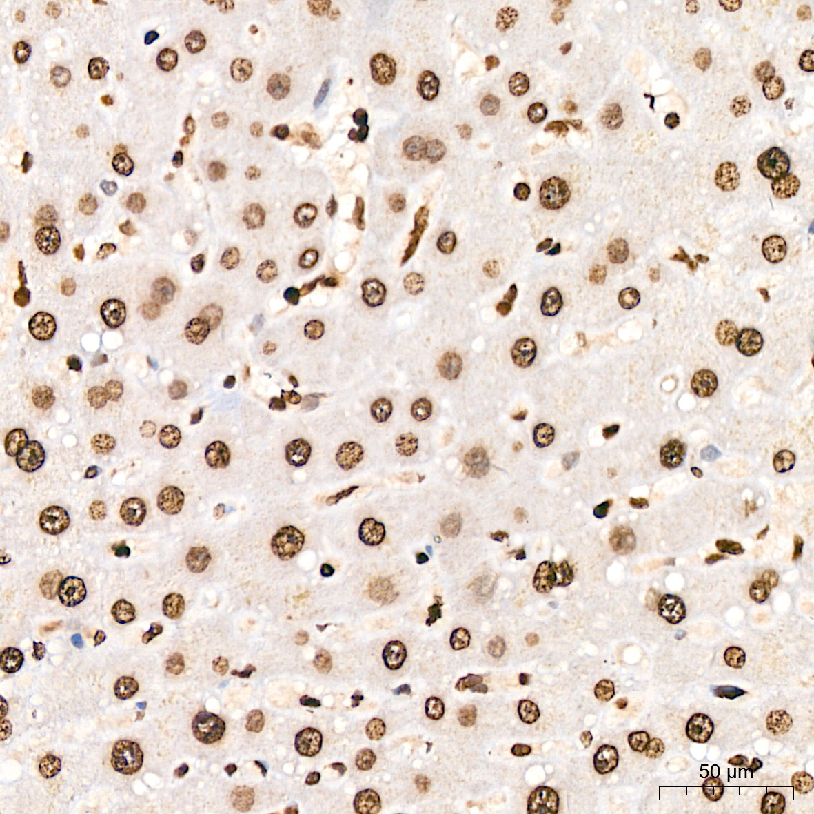 Symmetric DiMethyl-Histone H4-R3 Rabbit Polyclonal Antibody - Image 13