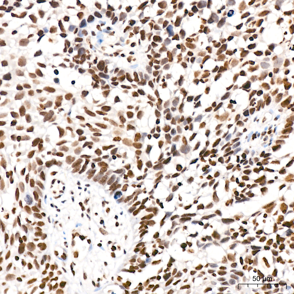 Symmetric DiMethyl-Histone H4-R3 Rabbit Polyclonal Antibody - Image 14