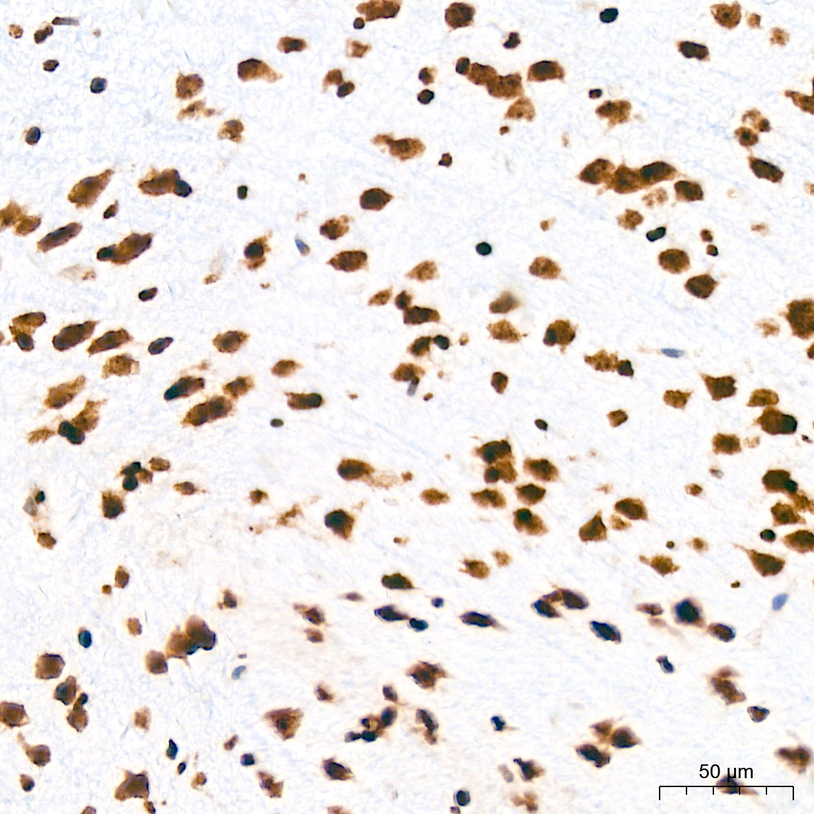 Symmetric DiMethyl-Histone H4-R3 Rabbit Polyclonal Antibody - Image 15