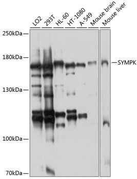 SYMPK Rabbit Polyclonal Antibody