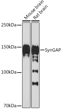 SynGAP Rabbit Monoclonal Antibody