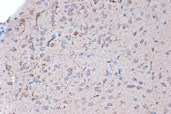 Syntenin Rabbit Monoclonal Antibody - Image 2