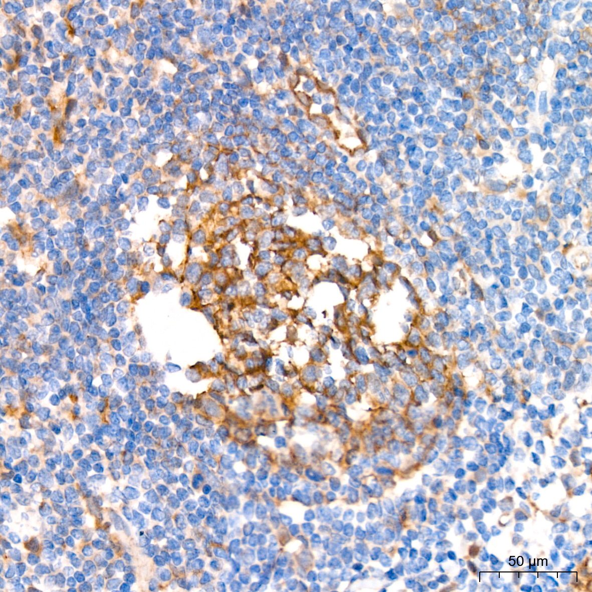 Syntenin Rabbit Monoclonal Antibody - Image 5