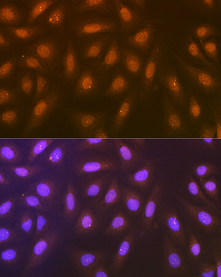 Syntenin Rabbit Monoclonal Antibody - Image 6