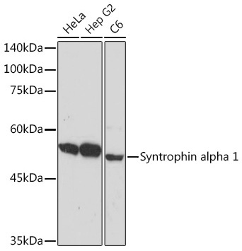 Syntrophin alpha 1 Rabbit Monoclonal Antibody