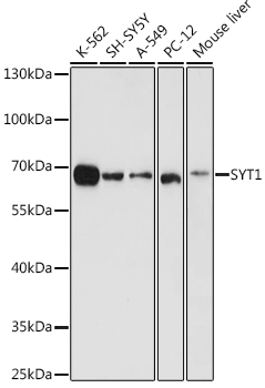 SYT1 Rabbit Polyclonal Antibody