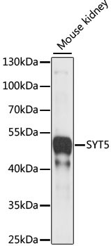 SYT5 Rabbit Polyclonal Antibody