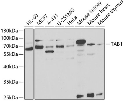 TAB1 Rabbit Polyclonal Antibody