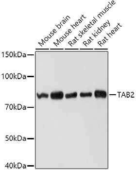 TAB2 Rabbit Polyclonal Antibody