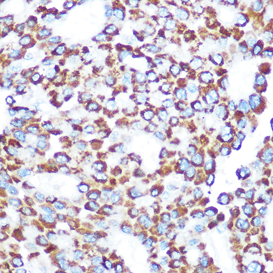 TAB3 Rabbit Polyclonal Antibody - Image 2