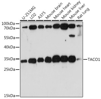 TACO1 Rabbit Polyclonal Antibody