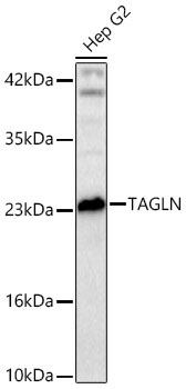 TAGLN Rabbit Polyclonal Antibody