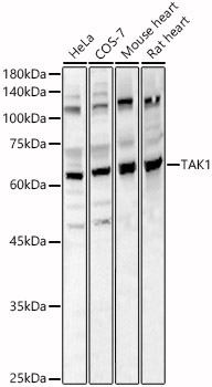 TAK1 Rabbit Polyclonal Antibody