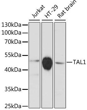 TAL1 Rabbit Polyclonal Antibody