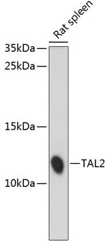 TAL2 Rabbit Polyclonal Antibody