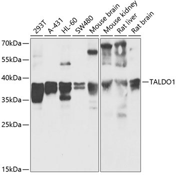 TALDO1 Rabbit Polyclonal Antibody