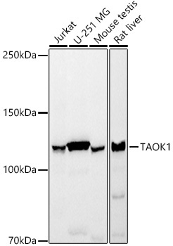TAOK1 Rabbit Monoclonal Antibody
