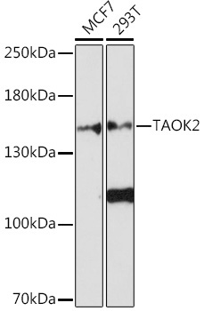 TAOK2 Rabbit Polyclonal Antibody