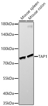 TAP1 Rabbit Monoclonal Antibody