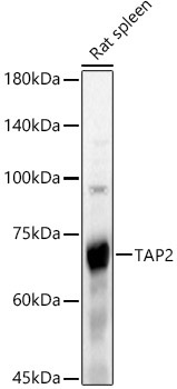 TAP2 Rabbit Polyclonal Antibody