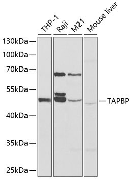 TAPBP Rabbit Polyclonal Antibody