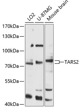 TARS2 Rabbit Polyclonal Antibody