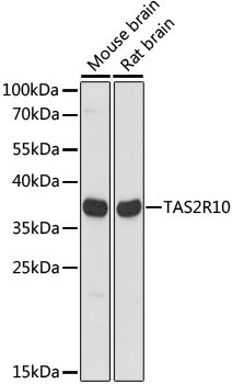 TAS2R10 Rabbit Polyclonal Antibody