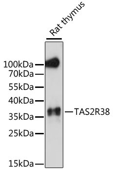TAS2R38 Rabbit Polyclonal Antibody