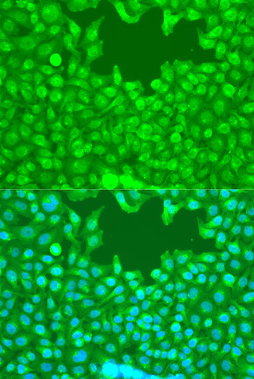 TAZ Rabbit Polyclonal Antibody - Image 2