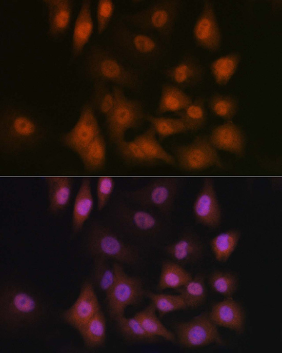 TAZ Rabbit Polyclonal Antibody - Image 2