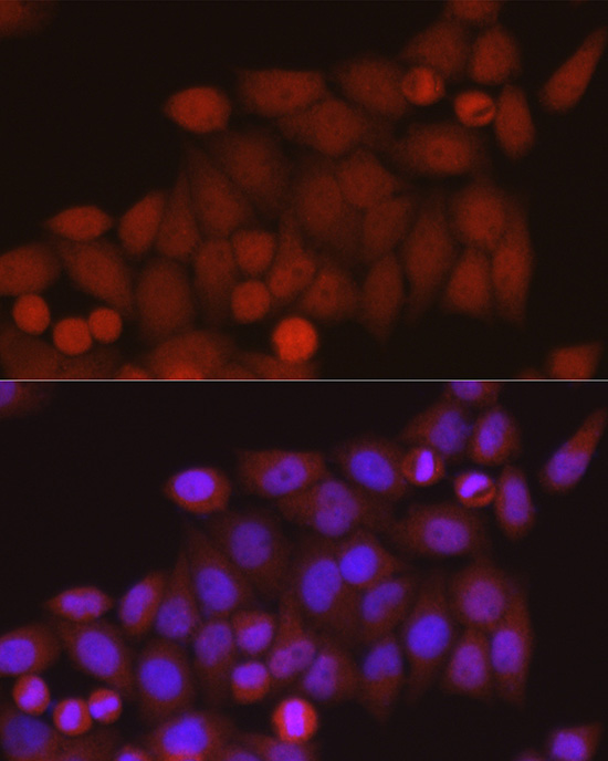 TAZ Rabbit Polyclonal Antibody - Image 3