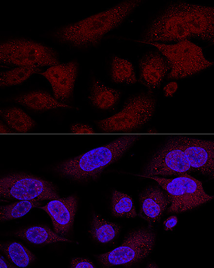 TAZ Rabbit Polyclonal Antibody - Image 11