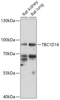 TBC1D16 Rabbit Polyclonal Antibody