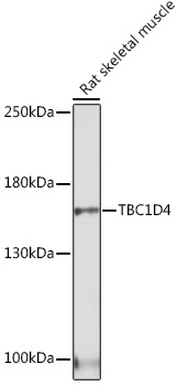 TBC1D4 Rabbit Polyclonal Antibody