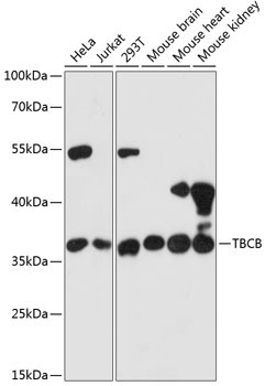 TBCB Rabbit Polyclonal Antibody