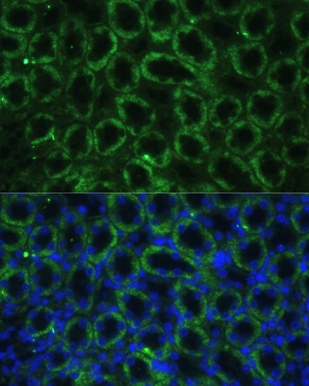 TBCE Rabbit Polyclonal Antibody