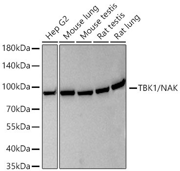TBK1/NAK Rabbit Monoclonal Antibody