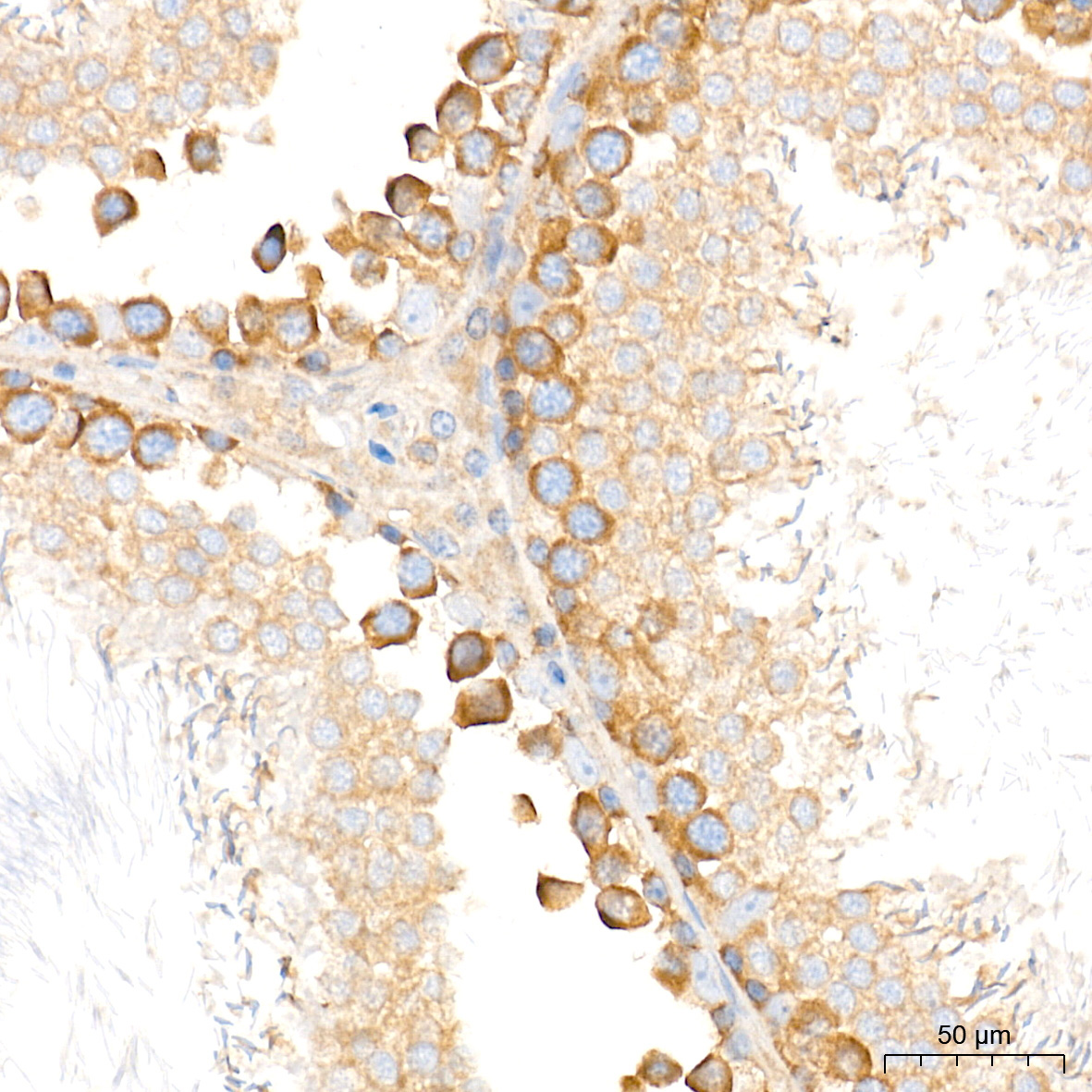 TBK1/NAK Rabbit Monoclonal Antibody - Image 4