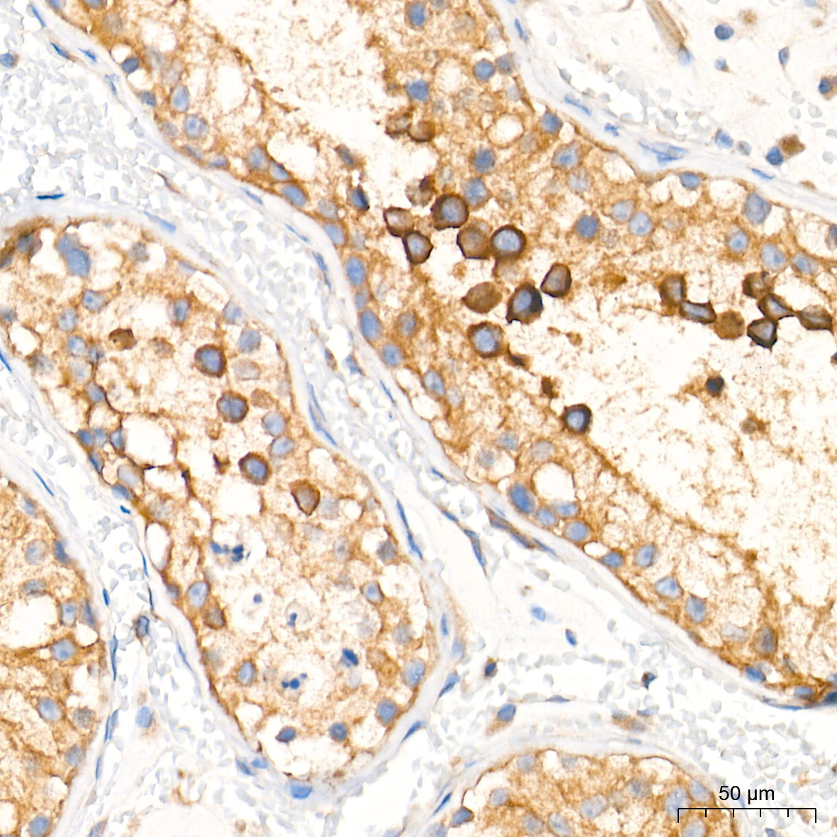 TBK1/NAK Rabbit Monoclonal Antibody - Image 5