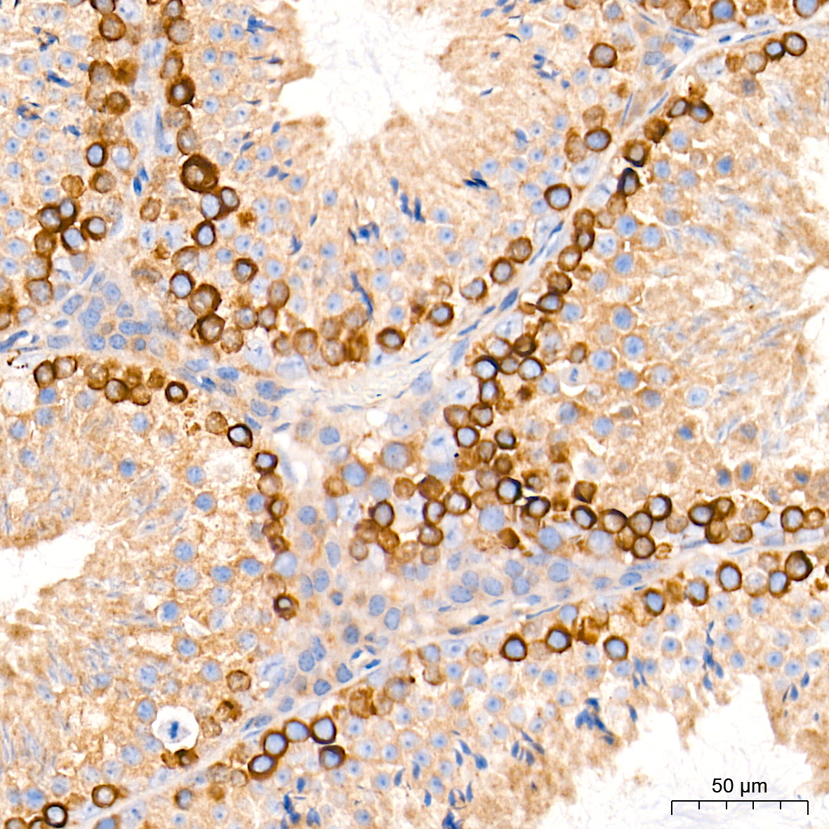 TBK1/NAK Rabbit Monoclonal Antibody - Image 6