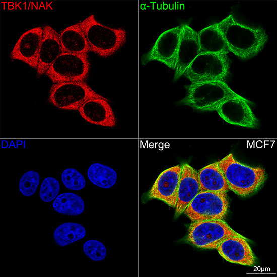 TBK1/NAK Rabbit Monoclonal Antibody - Image 7